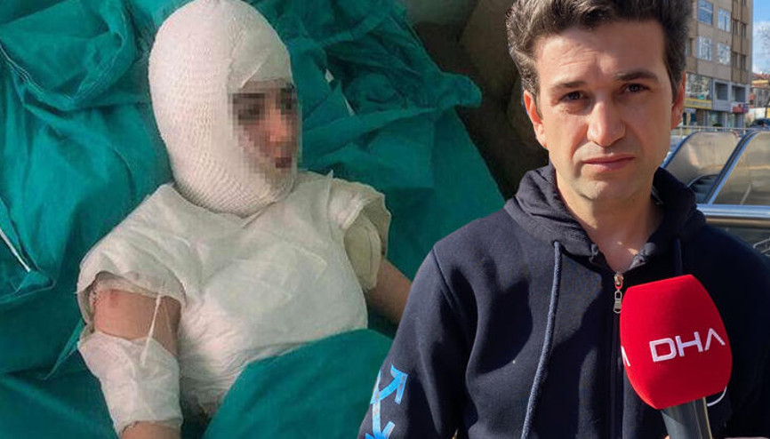 Kızı yanan baba konuştu