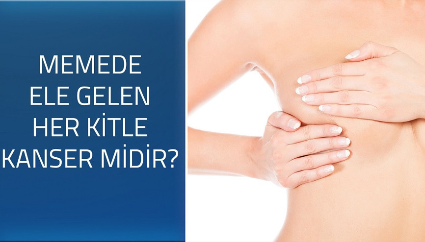 Memede ele gelen her kitle kanser midir