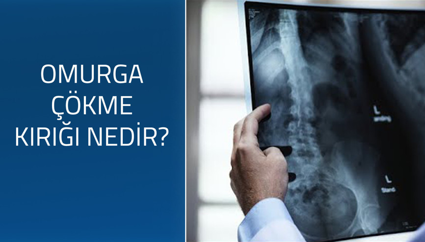 Omurga çökme kırığı nedir