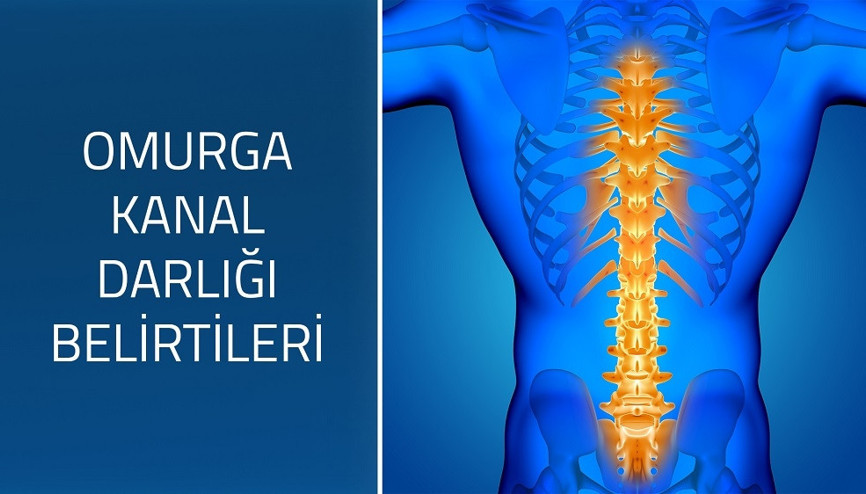 Omurga kanal darlığının belirtileri nelerdir