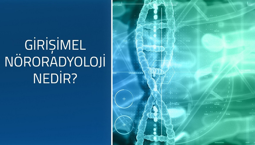 Girişimsel Nöroradyoloji nedir