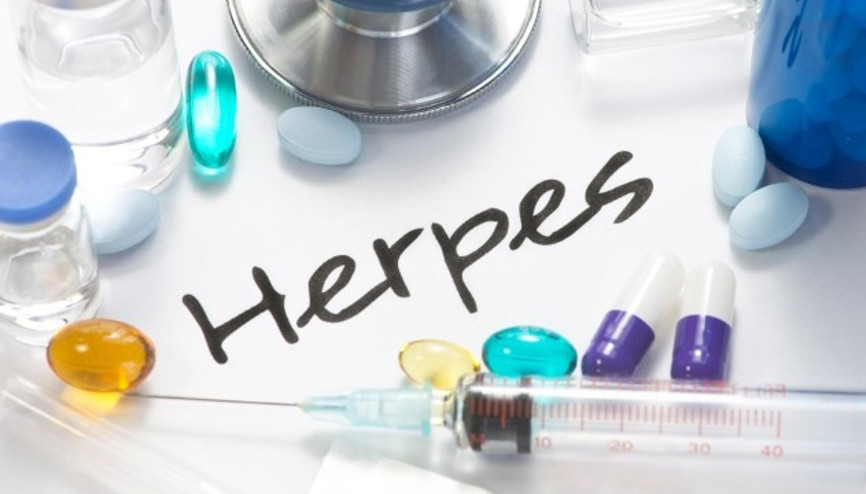 Genital Herpes Enfeksiyonu