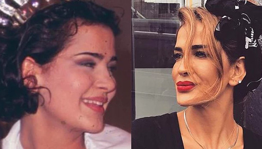 Emel Yıldırımdan yıllar sonra gelen itiraf: 2 yıl aynalara küstüm