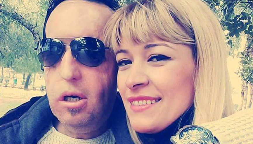 Yüz nakilli Recep Sert ile eşi Esma Sert boşanıyor Yüz nakilli Recep Sert ile eşi Esma Sert boşanıyor