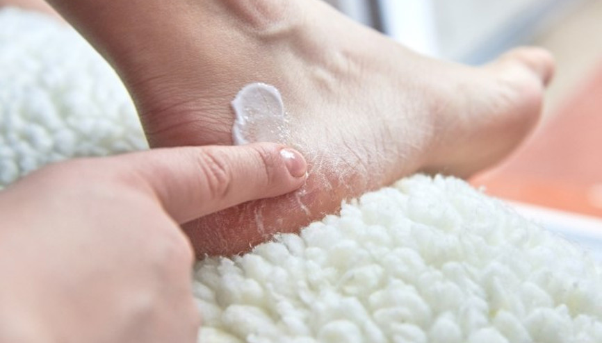 Topuk Dikeni Nedir Belirtileri ve Tedavisi Nasıldır