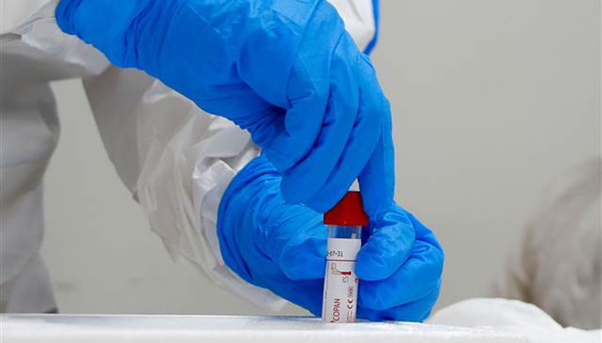 Zanzibarda ilk Corona Virüs vakası tespit edildi