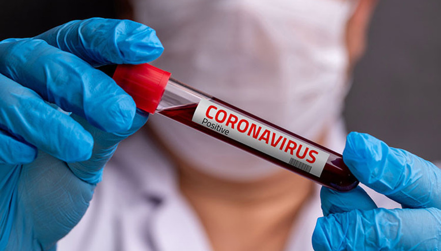 Böbrek hastaları koronavirüs enfeksiyonundan nasıl korunmalı