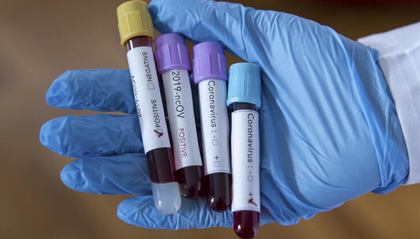 Zambiyada Kovid-19 kaynaklı ilk ölüm