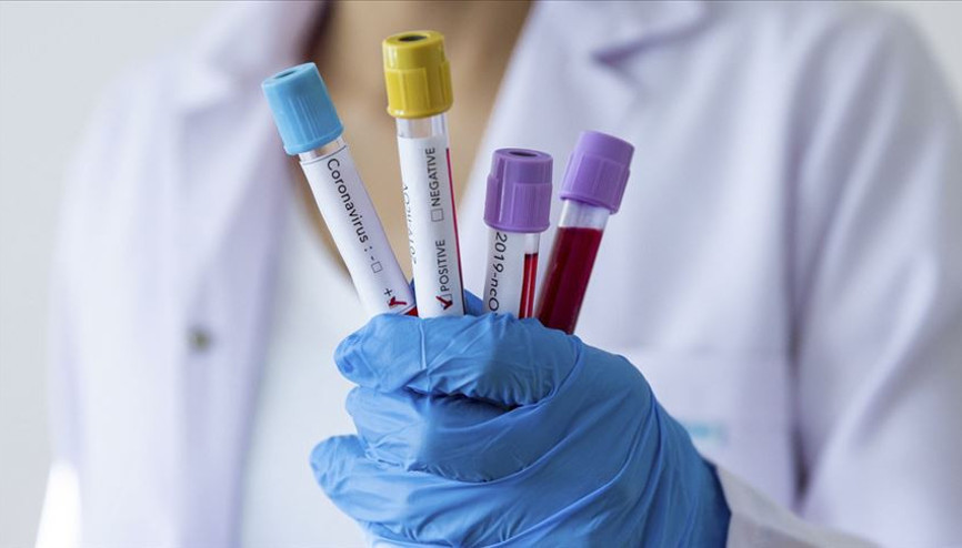 WTO: Küresel ticaret bu yıl yüzde 32’ye kadar daralabilir