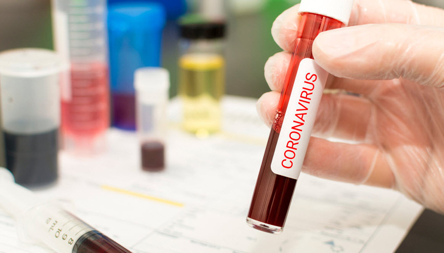 Koronavirüs salgını sektörleri nasıl etkiledi