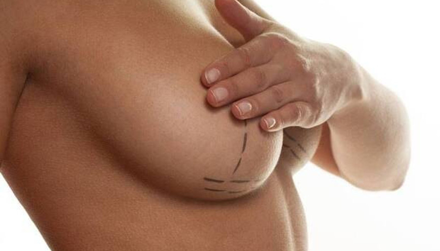 Göğüs büyütme ameliyatından önce bunları bilmenizde fayda var