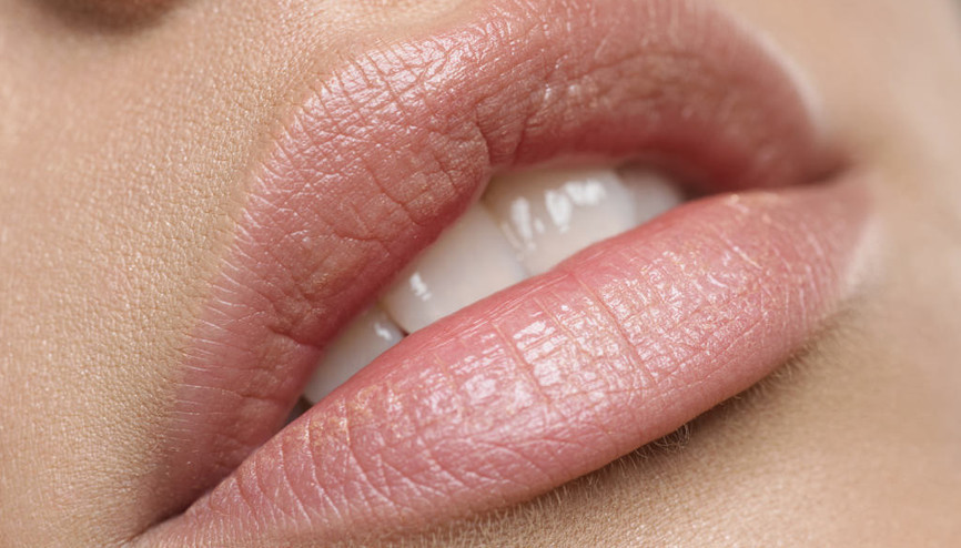 Dudak dolgusu estetiği