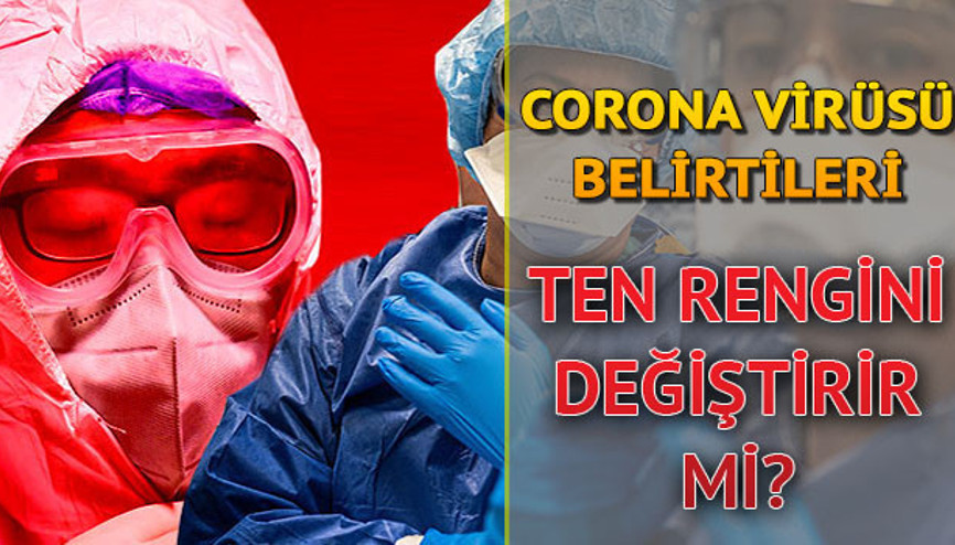 Corona virüsü semptomları neler Corona virüsü ten rengini değiştirir mi