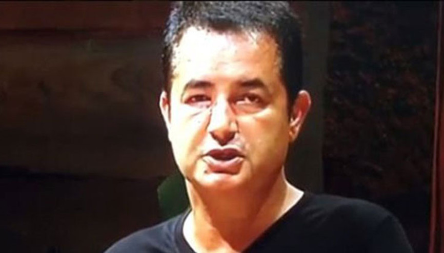 Acun Ilıcalı yüzündeki o şişliğin nedenini ilk kez anlattı