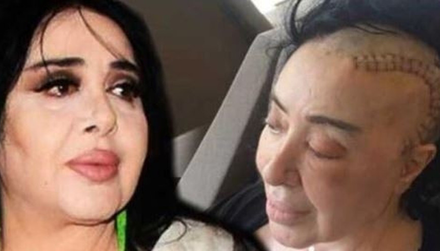 Nur Yerlitaş kimdir, evli miydi, çocuğu var mıydı Ölümüyle yasa boğan Nur Yerlitaşn hastalığı neydi