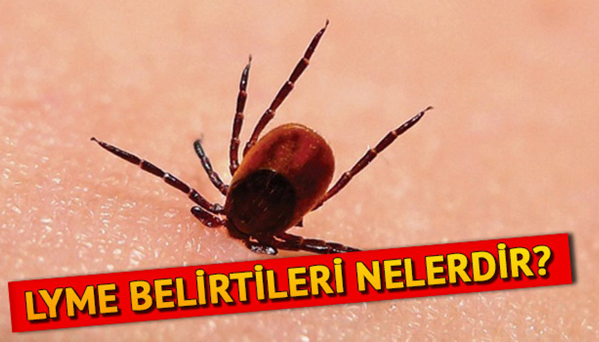 Lyme hastalığı nedir, belirtileri nelerdir Lyme hastalığı tedavisi var mı