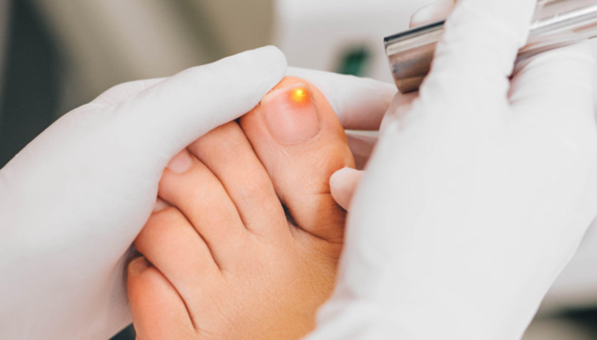 Tırnak mantarlarında beslenmenin etkisi