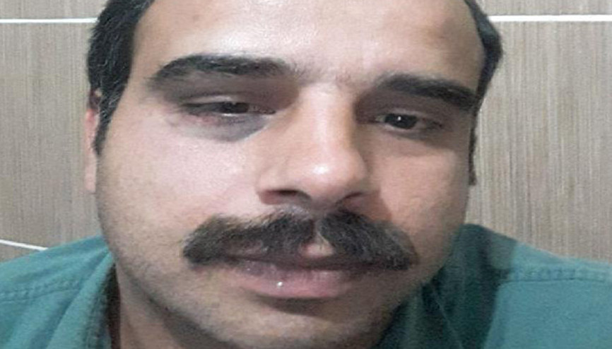 Viranşehir’de veteriner hekim darbedildi
