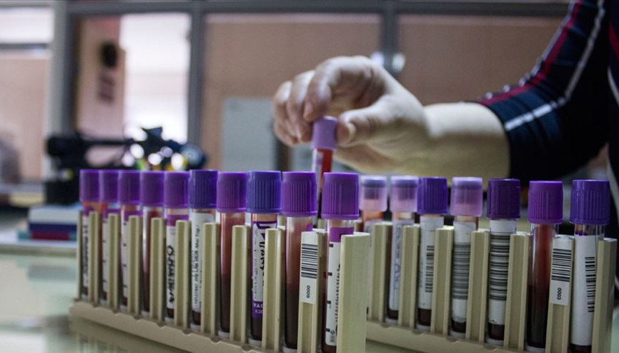 Talasemi nedir Talasemi hastalığı belirtileri nelerdir