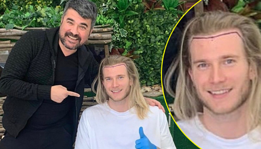 Loris Karius saç ektirdi