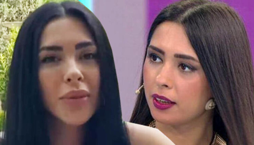 Ayşegül Doğandan canlı yayında estetik itirafı