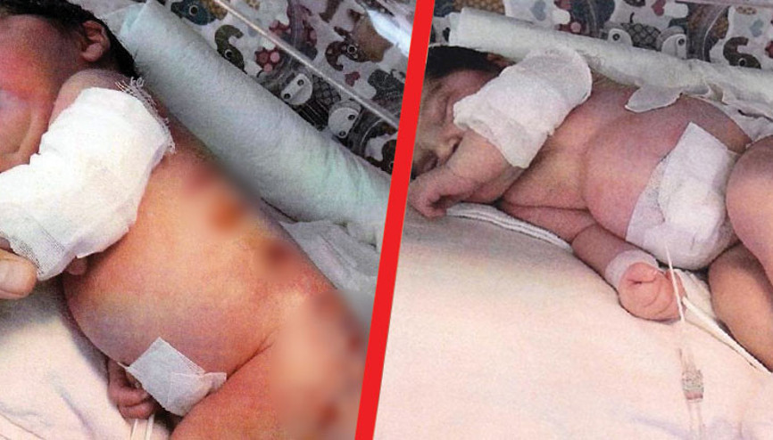 Doğumhanede üzerinde ısıtıcı unutuldu, 18 gün yoğun bakımda kaldı... Karar verildi Doğumhanede üzerinde ısıtıcı unutuldu, 18 gün yoğun bakımda kaldı... Karar verildi