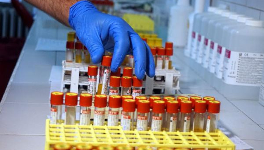 Koronavirüsle mücadelede kritik gelişme İstanbul Tıp Fakültesinde antikor testi yapılmaya başlandı
