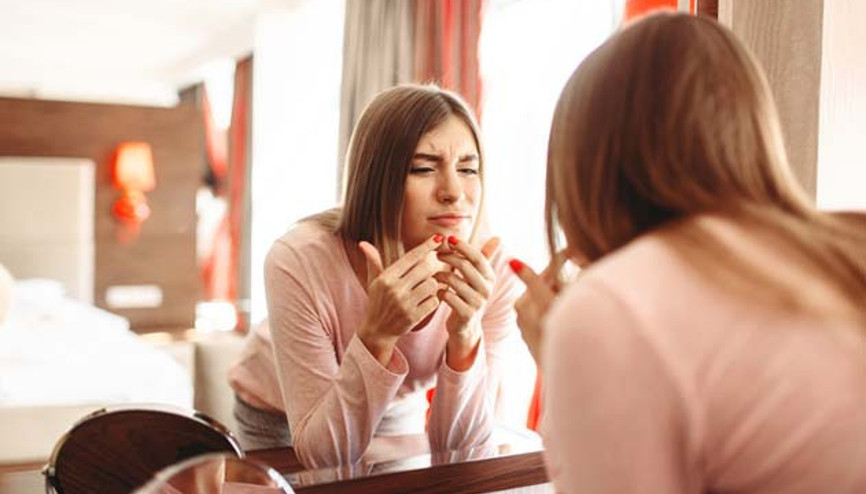 Akne Oluşumunu Önlemek İçin İpuçları