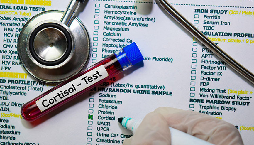 Kortizol nedir Kortizol değeri kaç olmalıdır Düşüklüğü ile yüksekliği nedenleri ve belirtileri
