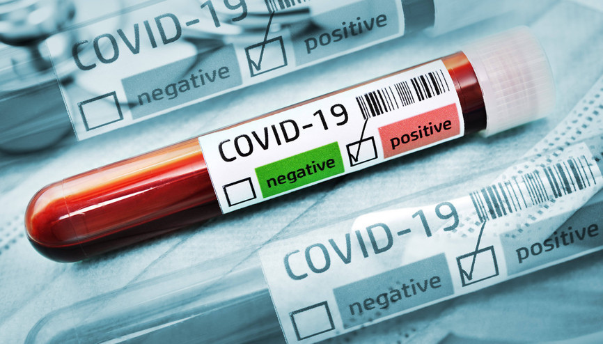 Üç futbolcunun testi pozitif çıktı, Dinamo Moskovanın maçı ertelendi