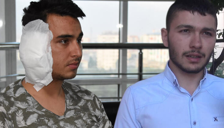 Postacının ısırılarak kopan kulağı yerine dikilemedi Postacının ısırılarak kopan kulağı yerine dikilemedi