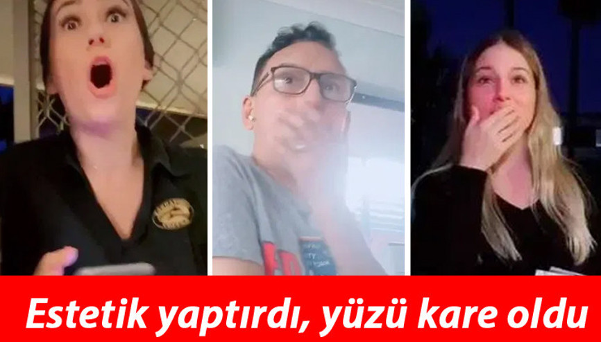 Estetik yaptırdı, yüzü kare oldu Onu gören yakınları şok geçirdi