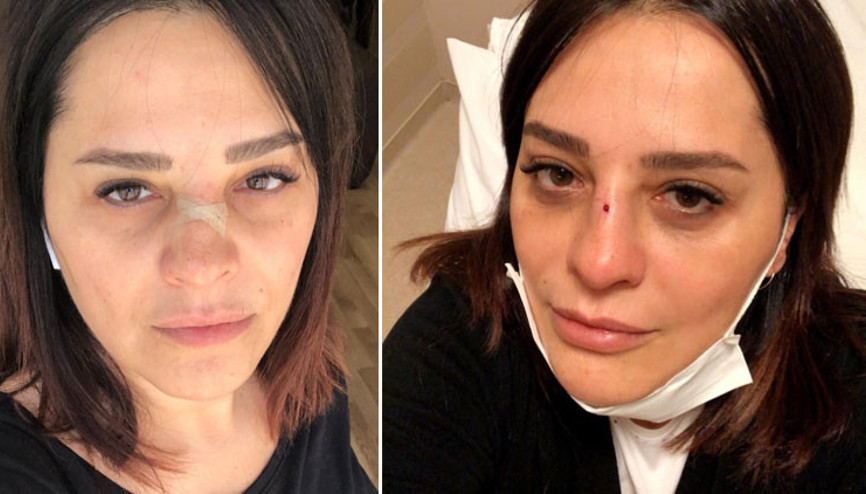 Reyhan Karaca kanlar içinde kaldı Korkutan kaza…