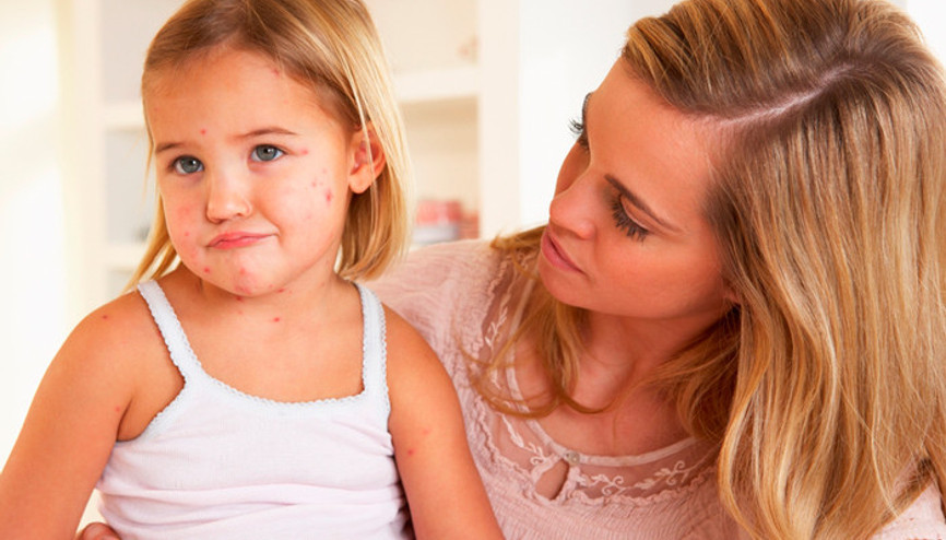 Her 3 çocuktan birinde görülüyor… Bu belirtilere dikkat