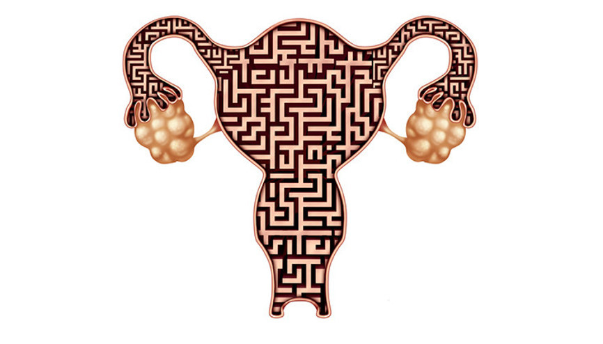 Labioplasti Nedir Nasıl Uygulanır Labioplasti Nedir Nasıl Uygulanır