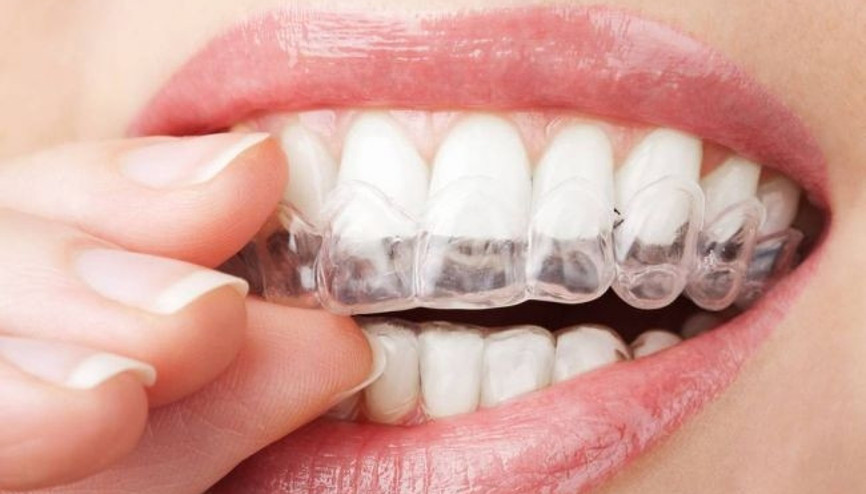 Ünlü isimler de bu yöntemi tercih ediyor