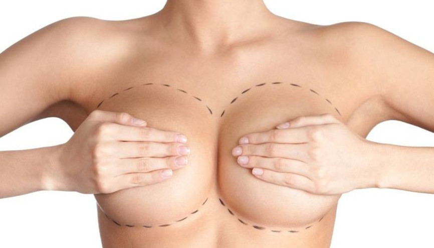 Göğüs büyütme ameliyatı