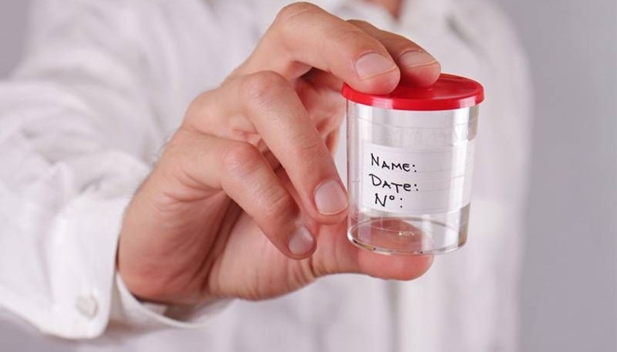 Spermiogram testi nedir