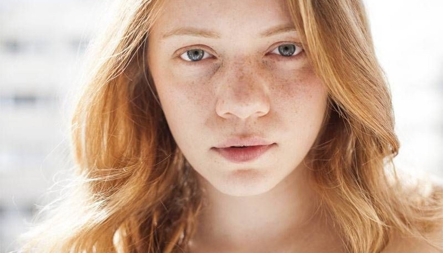 Çil lekesi için peeling nasıl uygulanır