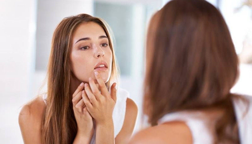 Sivilceleri azaltmak için 6 öneri