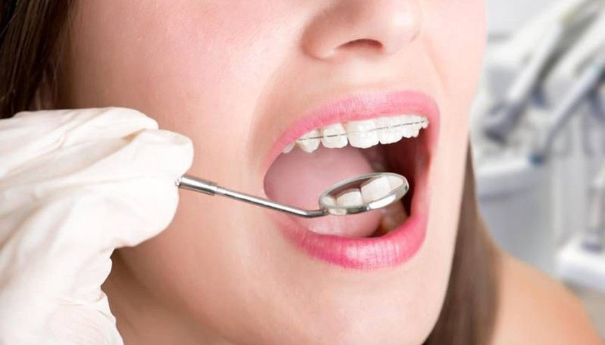 Ortodonti tedavi süresini kısaltan teknik