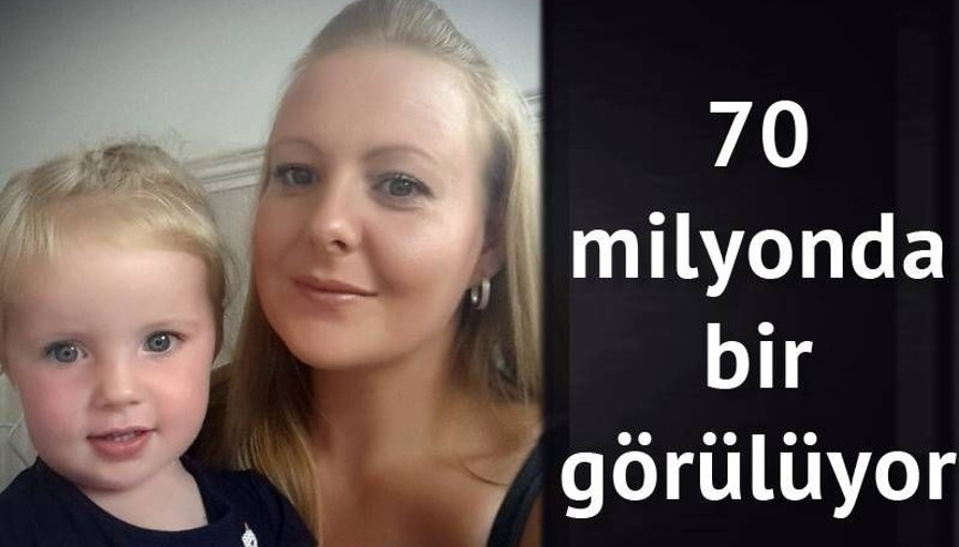 İki ikiz bebeğe aynı anda hamile kaldı