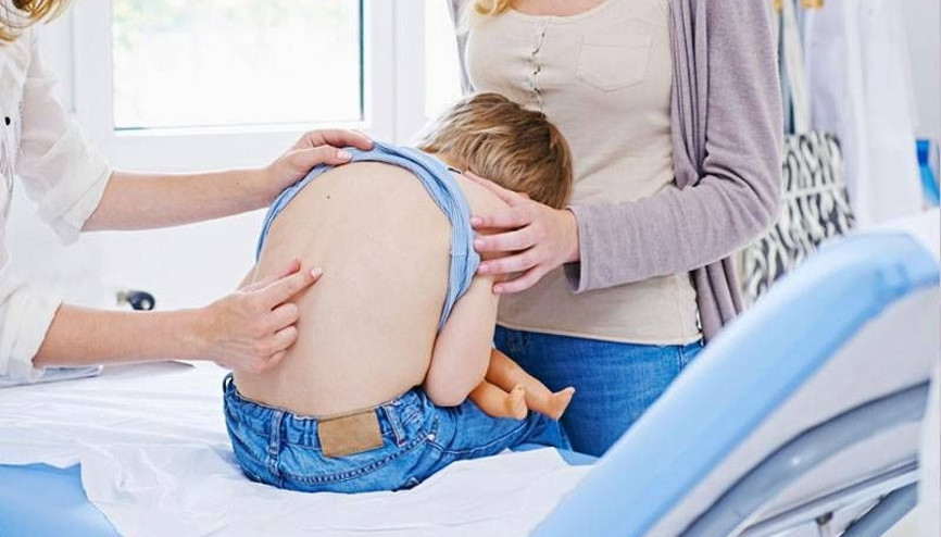 Çocuğumda skolyoz olduğunu nasıl anlarım