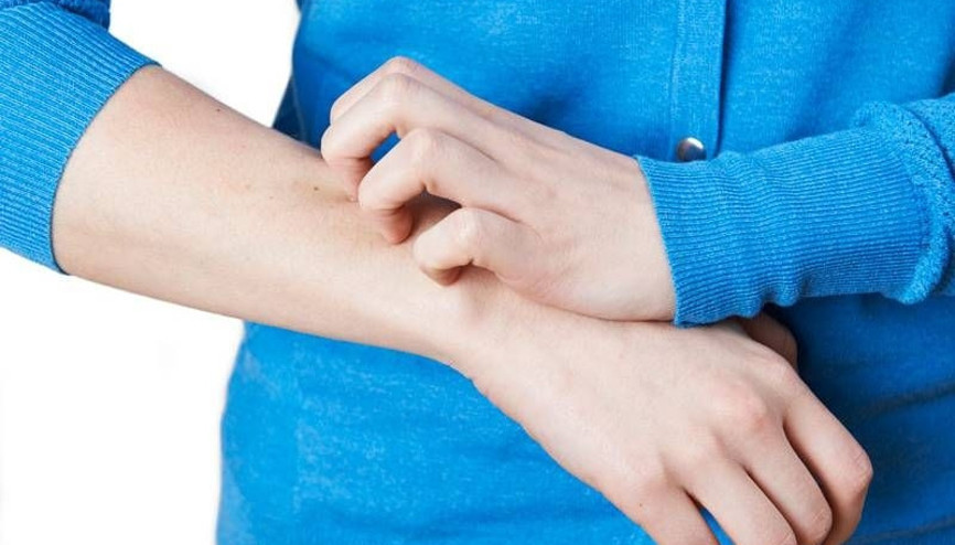 Sedef hastalığı tedavi edilebilir mi