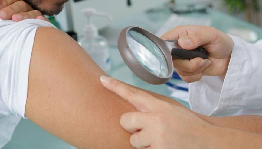 Vücudunuzdaki benlerin rengine dikkat