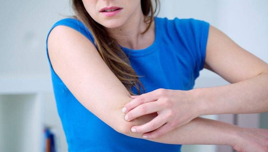 Erişkinlerde kaşıntı atopik dermatit nedeni olabilir