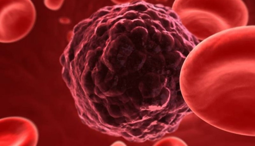 Kanser belirtileri nelerdir