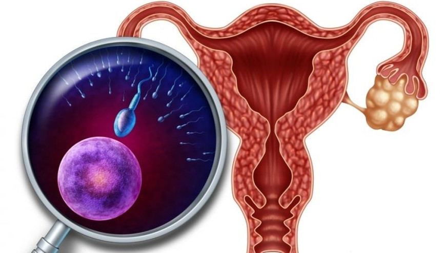 Hormonal düzensizliklerin neden olduğu yumurtalık kistlerini önemseyin