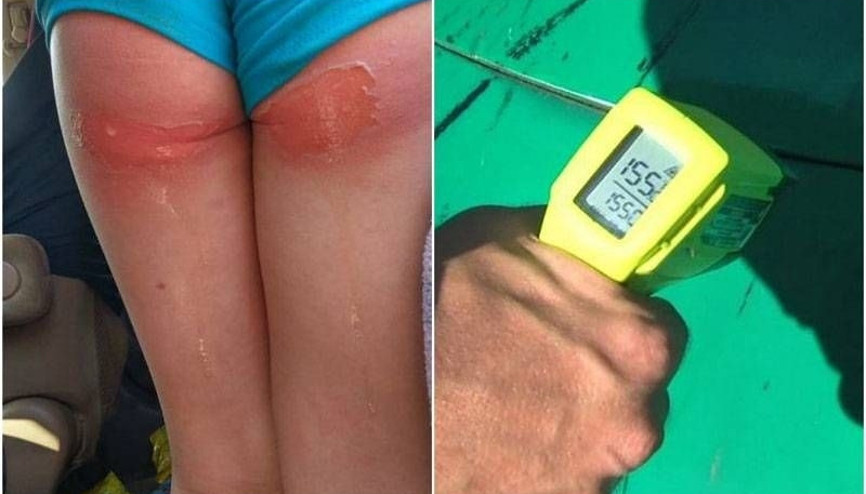 Oyun parkında küçük çocuğun başına bu geldi Oyun parkında küçük çocuğun başına bu geldi