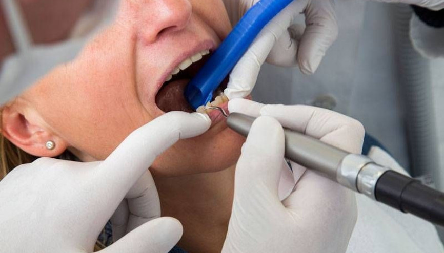 Dikkat, diş çürüğü erken doğum riskini artırıyor